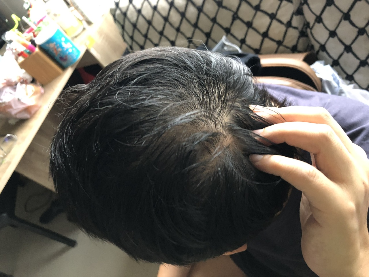 髮縫明顯好尷尬|🌿從「頭」開始的日常儀式|雍大生技神秘法的森頭皮精華液 - 第6張圖 髮縫明顯好尷尬|🌿從「頭」開始的日常儀式|雍大生技神秘法的森頭皮精華液