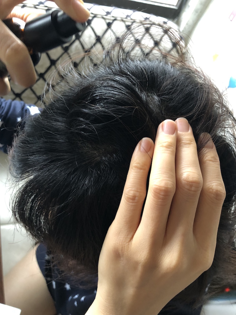 髮縫明顯好尷尬|🌿從「頭」開始的日常儀式|雍大生技神秘法的森頭皮精華液 - 第8張圖 髮縫明顯好尷尬|🌿從「頭」開始的日常儀式|雍大生技神秘法的森頭皮精華液